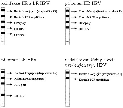 Genetica1