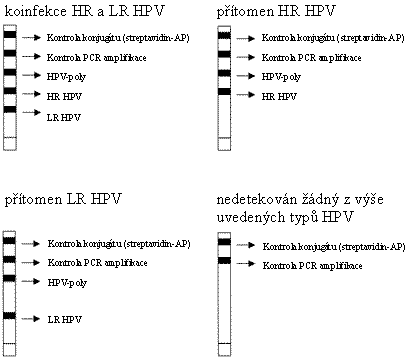 Genetica1